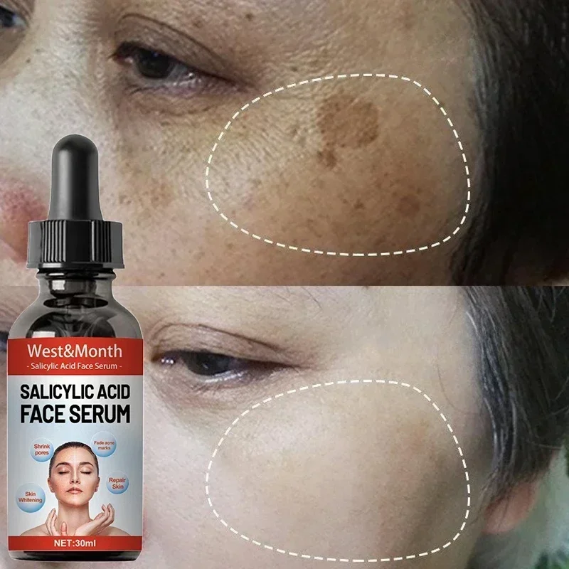 Licorice Root Extract - Serum Pemutih Penghilang Flek Hitam Ampuh,