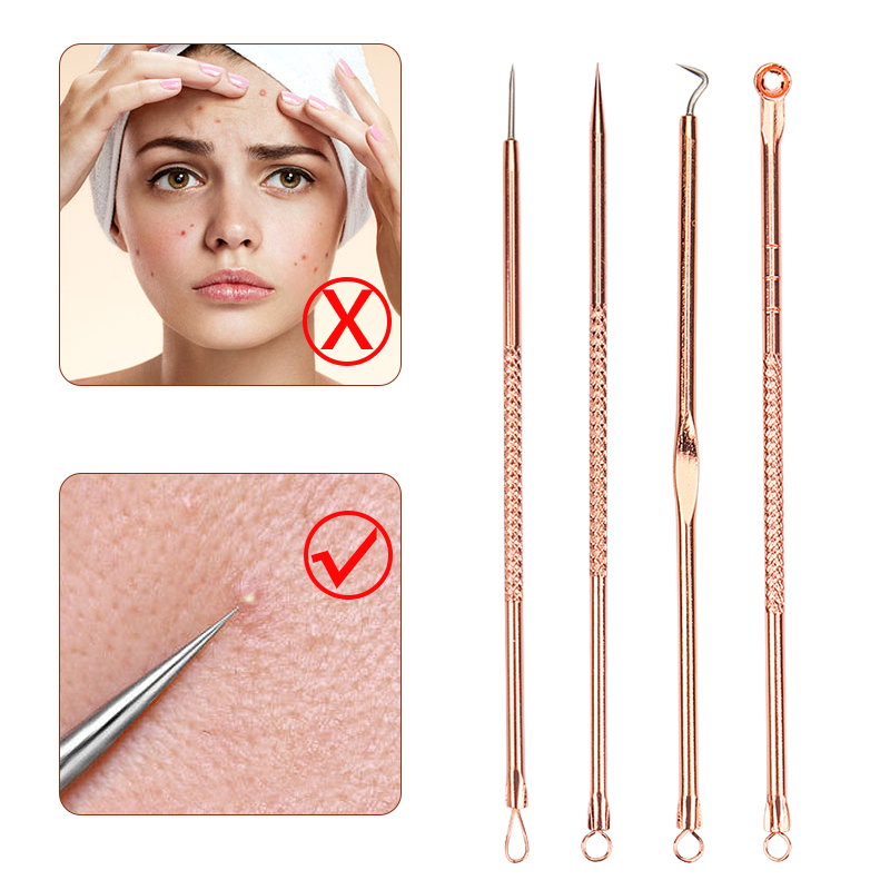 4 Buah/Set Set Jarum Komedo Je - Skincare Ingredients Checker ulasan dan harga