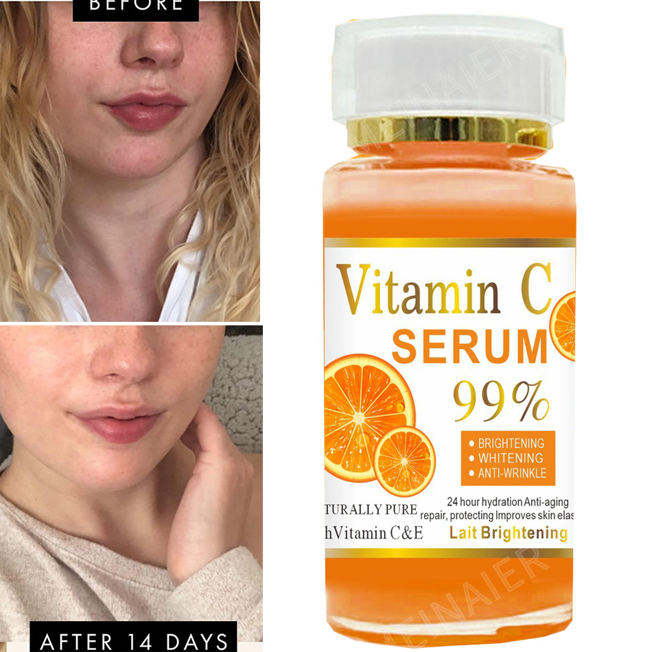 Serum Wajah Vitamin C 120ml, S - Skincare Garnier ulasan dan harga