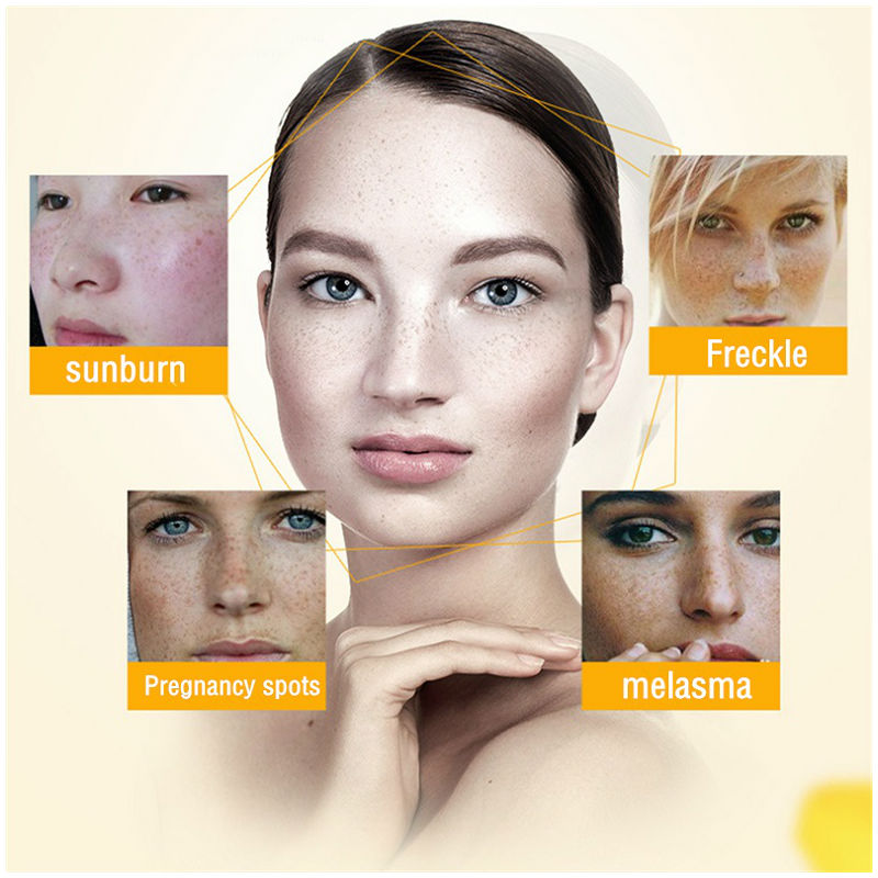 Dimollaure Krim Pemutih Bintik - Skincare Retinol ulasan dan harga