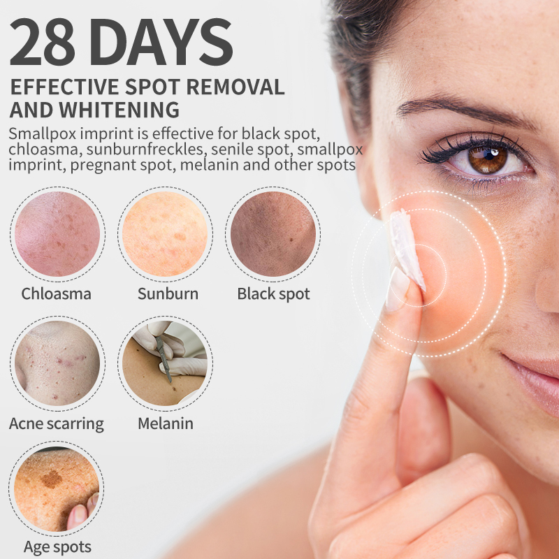 Dimollaure Krim Pemutih Bintik - Skincare Retinol ulasan dan harga