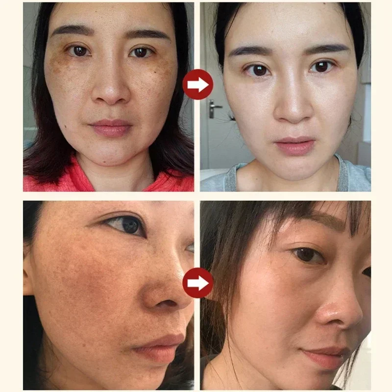 Serum Pemutih Penghilang Flek  - Licorice Root Extract ulasan dan harga