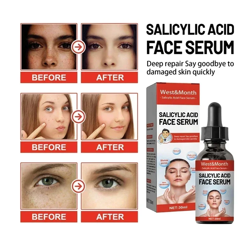 Serum Pemutih Penghilang Flek  - Licorice Root Extract ulasan dan harga